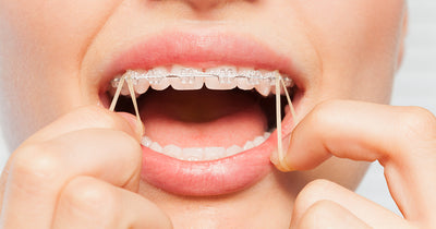 Importance of elastics in orthodontics